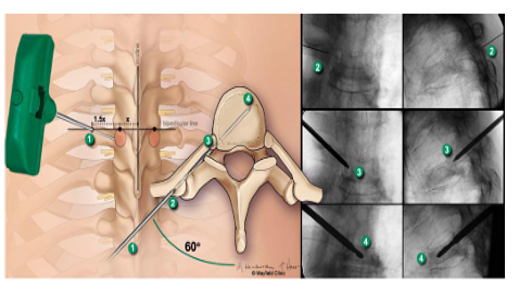 Xây dựng mô hình trồng cây dược liệu cà gai leo (Solanum Hainanense Hance) theo hướng GACP-WHO trên địa bàn tỉnh Hải Dương