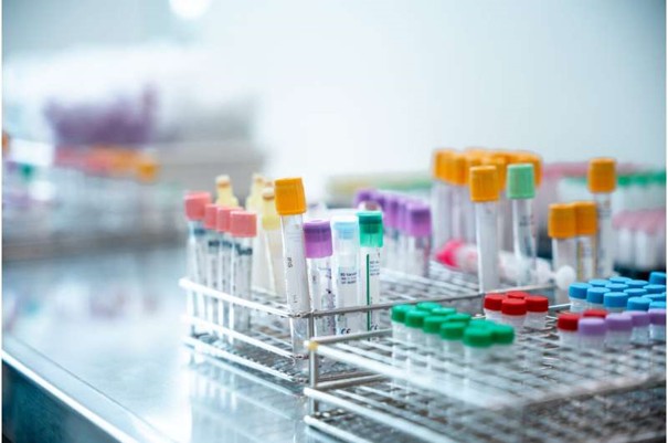 Nồng độ glucagon tăng sớm trong tiểu đường tuýp 2 có liên quan đến bệnh gan nhiễm mỡ