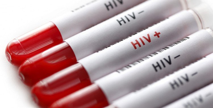 Phát hiện thuốc điều trị ung thư phổi có thể tiêu diệt các tế bào HIV