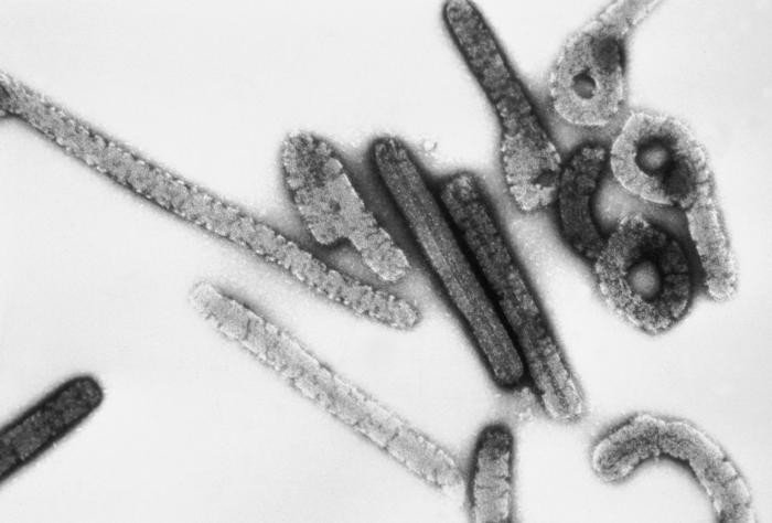 Bùng phát virus gây tử vong nguy hiểm như Ebola