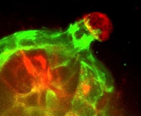 Các nhà khoa học phát hiện ra tế bào phòng chống ung thư vú