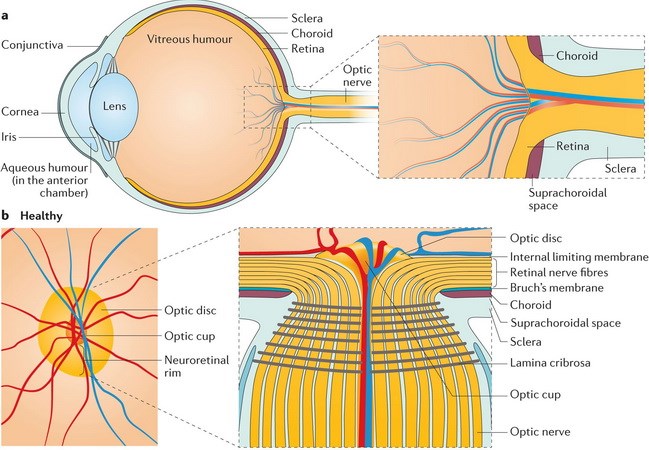 Xác định được 40 chuỗi ADN gây bệnh glaucoma dẫn tới mù lòa