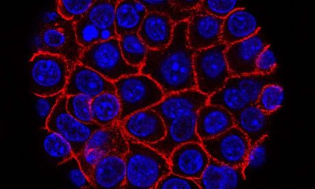 Phân tử lipid có ích đối với sự phát triển của tế bào ung thư