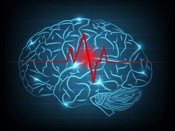 Các nhà nghiên cứu Hàn Quốc tạo ra "lưu huyết não đồ" mới