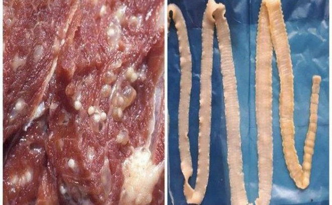 Chủ động phòng bệnh sán dây, ấu trùng sán lợn