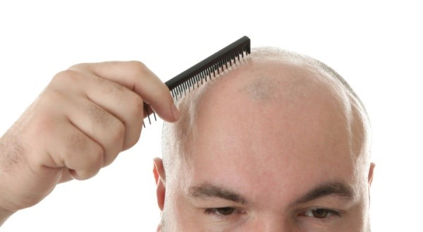 Liệu pháp 3D mới cho việc ngăn ngừa rụng tóc