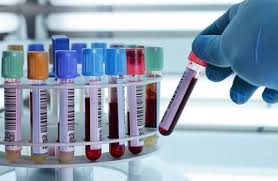 Xét nghiệm máu phát hiện hơn 50 loại ung thư trước khi có triệu chứng bệnh