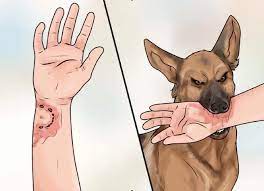 Cách sơ cứu khi bị chó cắn