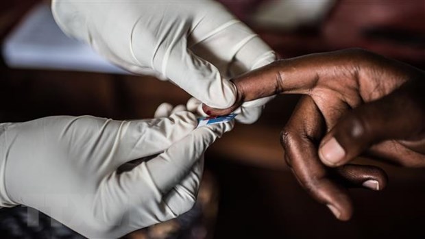 Mỹ phát triển phương pháp “tiêu diệt” HIV tiềm ẩn trong tế bào