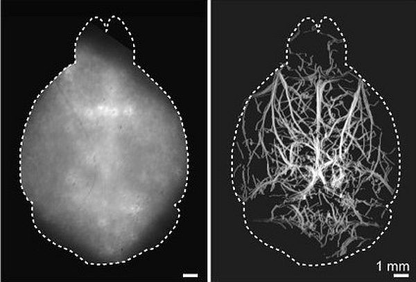 các nhà khoa học Thụy Sỹ đã tìm cách mở rộng độ sâu mà hình ảnh huỳnh quang vi mô có thể thâm nhập và lập bản đồ các cấu trúc bên trong bộ não.