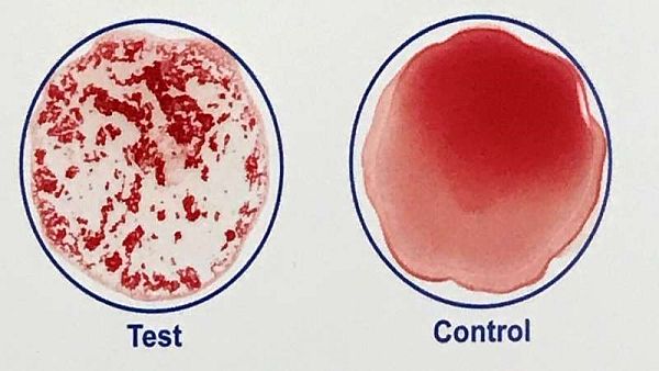 Xét nghiệm máu nhanh trong vài phút xác định ai đã tiêm chủng vắc xin COVID-19