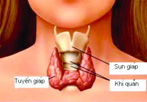 Nghiên cứu thực trạng suy tuyến giáp trên bà mẹ mang thai