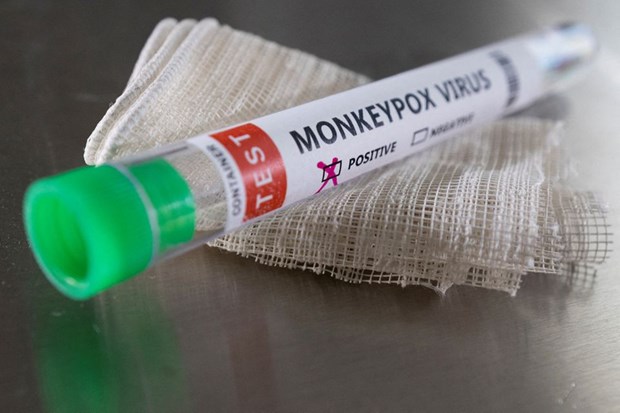 Italy thử nghiệm xét nghiệm nhanh với bệnh đậu mùa khỉ
