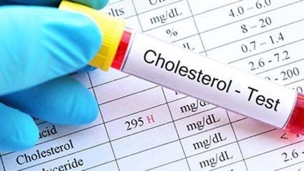 Nghiên cứu mới: 'Cholesterol tốt' không có lợi như người ta tưởng