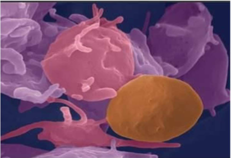 Ứng dụng quy trình gạn tách khối tiểu cầu túi ba từ một người cho và đề xuất một số tiêu chí chỉ định sử dụng khối tiểu cầu cho bệnh nhân giảm số lượng tiểu cầu