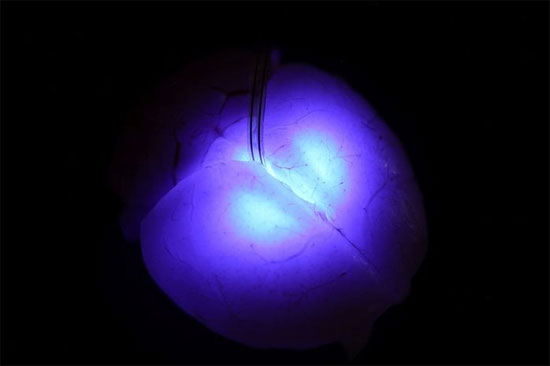 Đèn LED siêu nhỏ mới có khả năng tiêm vào não bộ 