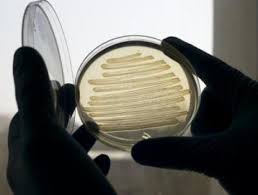 Vi khuẩn E.coli đặc biệt sản xuất diesel theo nhu cầu 