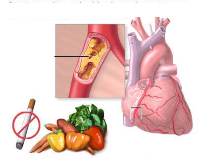 Phương pháp ăn uống để phòng chống bệnh tim  mạch