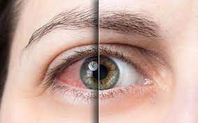 4 dược liệu giúp bổ mắt